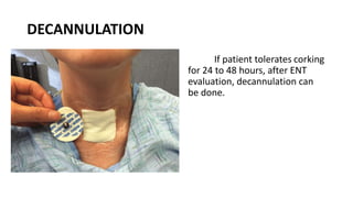 Tracheostomy detailed procedure method . | PDF