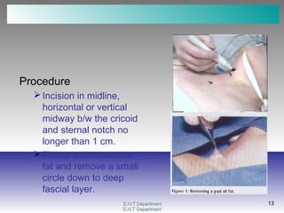 E.N.T DepartmentE.N.T Department
13
E.N.T DepartmentE.N.T Department
13
Procedure
Incision in midline,
horizontal or vertical
midway b/w the cricoid
and sternal notch no
longer than 1 cm.
Pickup subcutaneous
fat and remove a small
circle down to deep
fascial layer.
 