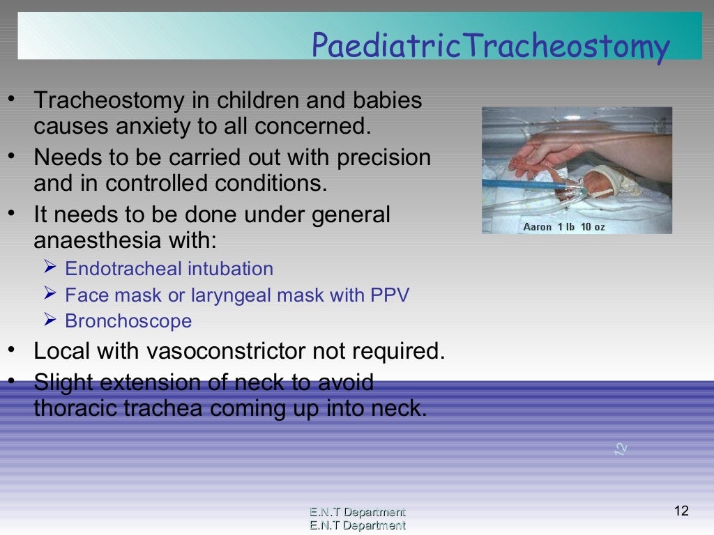 Tracheostomy surgical procedure