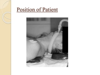 Position of Patient
 