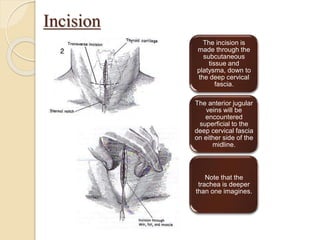 Incision
The incision is
made through the
subcutaneous
tissue and
platysma, down to
the deep cervical
fascia.
The anterior jugular
veins will be
encountered
superficial to the
deep cervical fascia
on either side of the
midline.
Note that the
trachea is deeper
than one imagines.
 