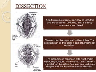 DISSECTION
A self-retaining retractor can now be inserted
and the dissection continued until the strap
muscles are encountered.
These should be separated in the midline. The
assistant can do this using a pair of Langenbeck
retractors.
The dissection is continued with blunt ended
dissecting scissors. If one stays in the midline, it
is a relatively bloodless field and one continues
deeper until the thyroid isthmus is identified.
 
