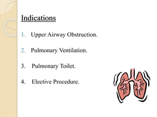 Indications
1. Upper Airway Obstruction.
2. Pulmonary Ventilation.
3. Pulmonary Toilet.
4. Elective Procedure.
 