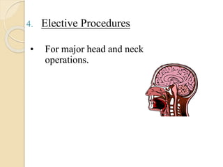 4. Elective Procedures
• For major head and neck
operations.
 