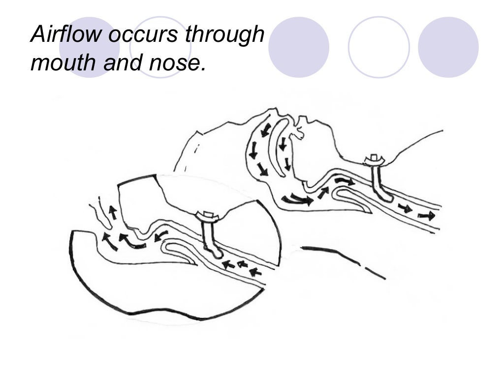 Tracheostomy and its post op care last