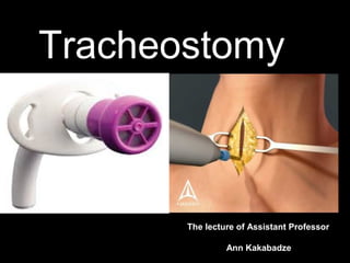 The lecture of Assistant Professor
Ann Kakabadze
Tracheostomy
 