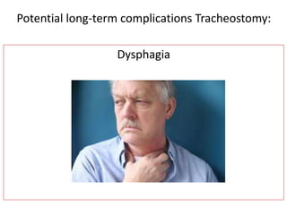 Dysphagia
Potential long-term complications Tracheostomy:
 