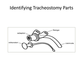 Identifying Tracheostomy Parts
 