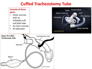Cuffed Tracheostomy Tube
Consists of three
parts:
• Outer cannula
with an
inflatable cuff
and pilot tube
• An inner cannula
• An obturator
 