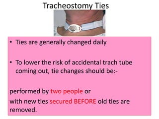 • Ties are generally changed daily
• To lower the risk of accidental trach tube
coming out, tie changes should be:-
performed by two people or
with new ties secured BEFORE old ties are
removed.
Tracheostomy Ties
 