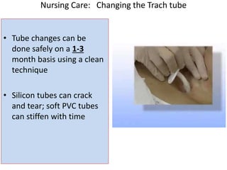 • Tube changes can be
done safely on a 1-3
month basis using a clean
technique
• Silicon tubes can crack
and tear; soft PVC tubes
can stiffen with time
Nursing Care: Changing the Trach tube
 