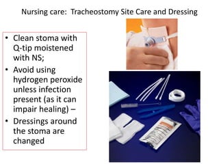 • Clean stoma with
Q-tip moistened
with NS;
• Avoid using
hydrogen peroxide
unless infection
present (as it can
impair healing) –
• Dressings around
the stoma are
changed
Nursing care: Tracheostomy Site Care and Dressing
 