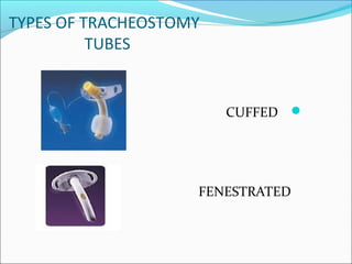 TYPES OF TRACHEOSTOMY
TUBES
CUFFED
FENESTRATED
 