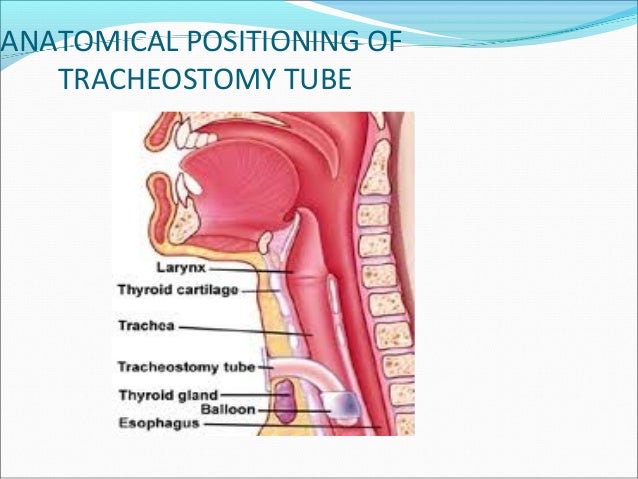 tracheostomy anatomy under fontanacountryinn com tracheostomy anatomy