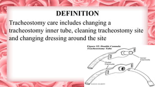 DEFINITION
Tracheostomy care includes changing a
tracheostomy inner tube, cleaning tracheostomy site
and changing dressing around the site
 