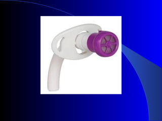 Tracheostomy  and post op care