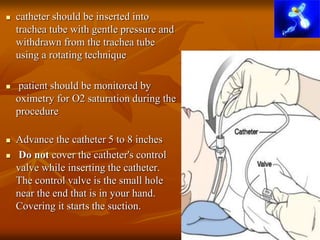 catheter should be inserted into
trachea tube with gentle pressure and
withdrawn from the trachea tube
using a rotating technique
 patient should be monitored by
oximetry for O2 saturation during the
procedure
 Advance the catheter 5 to 8 inches
 Do not cover the catheter's control
valve while inserting the catheter.
The control valve is the small hole
near the end that is in your hand.
Covering it starts the suction.
 