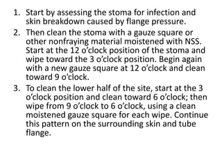 1. Start by assessing the stoma for infection and
skin breakdown caused by flange pressure.
2. Then clean the stoma with a gauze square or
other nonfraying material moistened with NSS.
Start at the 12 o’clock position of the stoma and
wipe toward the 3 o’clock position. Begin again
with a new gauze square at 12 o’clock and clean
toward 9 o’clock.
3. To clean the lower half of the site, start at the 3
o’clock position and clean toward 6 o’clock; then
wipe from 9 o’clock to 6 o’clock, using a clean
moistened gauze square for each wipe. Continue
this pattern on the surrounding skin and tube
flange.
 