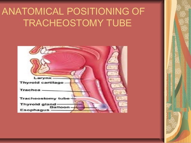 Tracheostomy care bitto