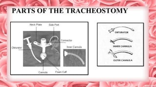 PARTS OF THE TRACHEOSTOMY
 
