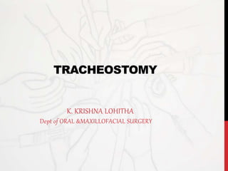 TRACHEOSTOMY
K. KRISHNA LOHITHA
Dept of ORAL &MAXILLOFACIAL SURGERY
 