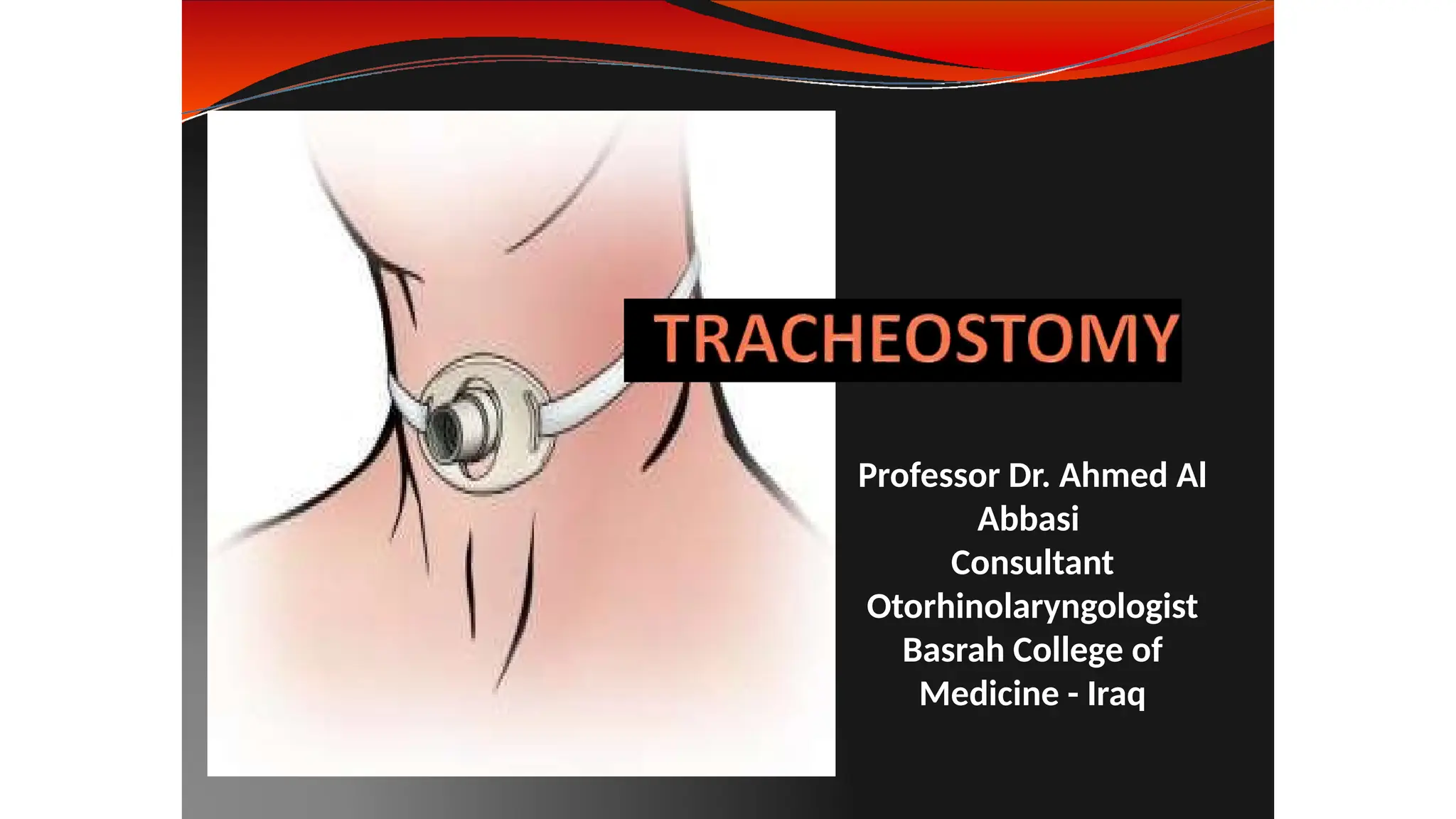 tracheostomy new (2).power point presentation | PPTX