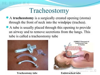 Tracheostomy
A tracheostomy is a surgically created opening (stoma)
through the front of neck into the windpipe (trachea).
A tube is usually placed through this opening to provide
an airway and to remove secretions from the lungs. This
tube is called a tracheostomy tube
Endotracheal tubeTracheostomy tube
 