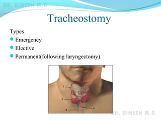 Tracheostomy
Types
Emergency
Elective
Permanent(following laryngectomy)
 