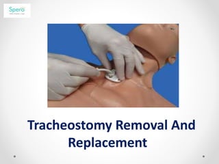 Tracheostomy Removal And
Replacement
 