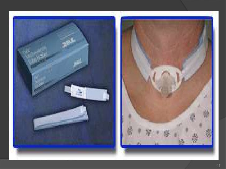 Tracheostomy site care procedure