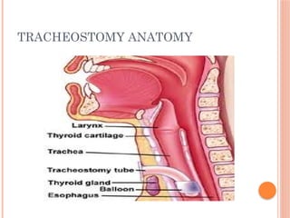 TRACHEOSTOMY ANATOMY
 