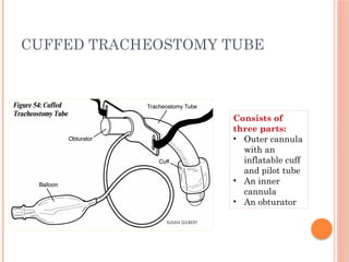 CUFFED TRACHEOSTOMY TUBE
Consists of
three parts:
• Outer cannula
with an
inflatable cuff
and pilot tube
• An inner
cannula
• An obturator
 