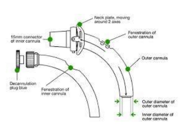 Shiley Pediatric Tracheostomy Tube Size Chart