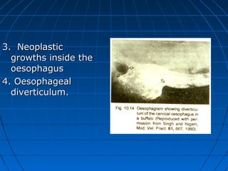 3. Neoplastic
  growths inside the
  oesophagus
4. Oesophageal
  diverticulum.
 