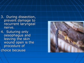 3. During dissection,
  prevent damage to
  recurrent laryngeal
  nerve.
4. Suturing only
  oesophagus and
  leaving the skin
  wound open is the
  procedure of
choice because
 