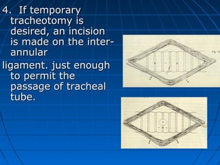 4. If temporary
  tracheotomy is
  desired, an incision
  is made on the inter-
  annular
ligament. just enough
  to permit the
  passage of tracheal
  tube.
 