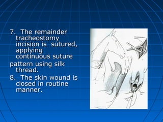 7. The remainder
  tracheostomy
  incision is sutured,
  applying
  continuous suture
pattern using silk
  thread.
8. The skin wound is
  closed in routine
  manner.
 