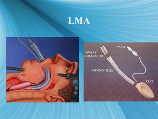 LMA
LMA
QuickTime™ and a
decompressor
are needed to see this picture.
QuickTime™ and a
decompressor
are needed to see this...