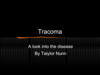 Tracoma

A look into the disease
   By Taiylor Nunn
 