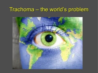 Trachoma – the world’s problemTrachoma – the world’s problem
 
