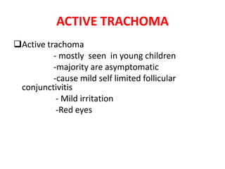 ACTIVE TRACHOMA
Active trachoma
- mostly seen in young children
-majority are asymptomatic
-cause mild self limited follicular
conjunctivitis
- Mild irritation
-Red eyes

 