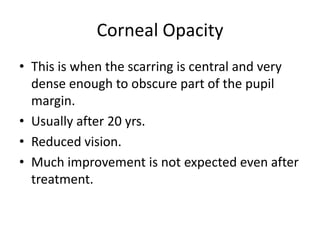 Corneal Opacity
• This is when the scarring is central and very
dense enough to obscure part of the pupil
margin.
• Usually after 20 yrs.
• Reduced vision.
• Much improvement is not expected even after
treatment.

 