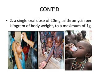 CONT’D
• 2. a single oral dose of 20mg azithromycin per
kilogram of body weight, to a maximum of 1g

 