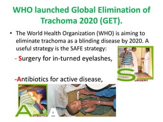 WHO launched Global Elimination of
Trachoma 2020 (GET).
• The World Health Organization (WHO) is aiming to
eliminate trachoma as a blinding disease by 2020. A
useful strategy is the SAFE strategy:

- Surgery for in-turned eyelashes,
-Antibiotics for active disease,

 