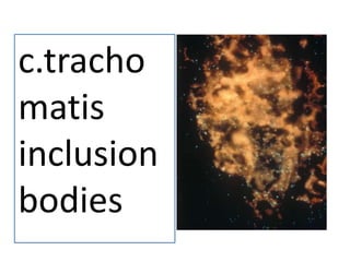 c.tracho
matis
inclusion
bodies

 