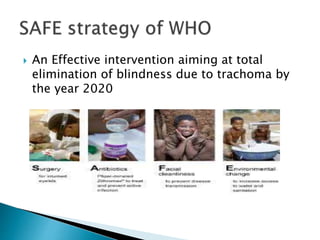  An Effective intervention aiming at total
elimination of blindness due to trachoma by
the year 2020
 