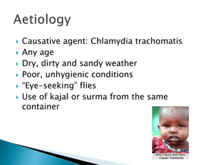  Causative agent: Chlamydia trachomatis
 Any age
 Dry, dirty and sandy weather
 Poor, unhygienic conditions
 “Eye-seeking” flies
 Use of kajal or surma from the same
container
 