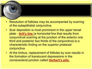 • Resolution of follicles may be accompanied by scarring
of the subepithelial conjunctiva.
• Scar deposition is most prominent in the upper tarsal
plate - Arlt's line (a horizontal line that results from
conjunctival scarring at the junction of the anterior one
third and posterior two thirds of the conjunctiva) is a
characteristic finding on the superior pretarsal
conjunctiva.
• At the limbus, replacement of follicles by scar results in
the formation of translucent depressions in the
corneoscleral junction called Herbert’s pits.
 