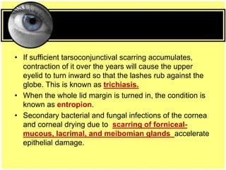• If sufficient tarsoconjunctival scarring accumulates,
contraction of it over the years will cause the upper
eyelid to turn inward so that the lashes rub against the
globe. This is known as trichiasis.
• When the whole lid margin is turned in, the condition is
known as entropion.
• Secondary bacterial and fungal infections of the cornea
and corneal drying due to scarring of forniceal-
mucous, lacrimal, and meibomian glands accelerate
epithelial damage.
 