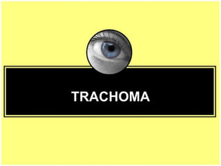 TRACHOMA
 